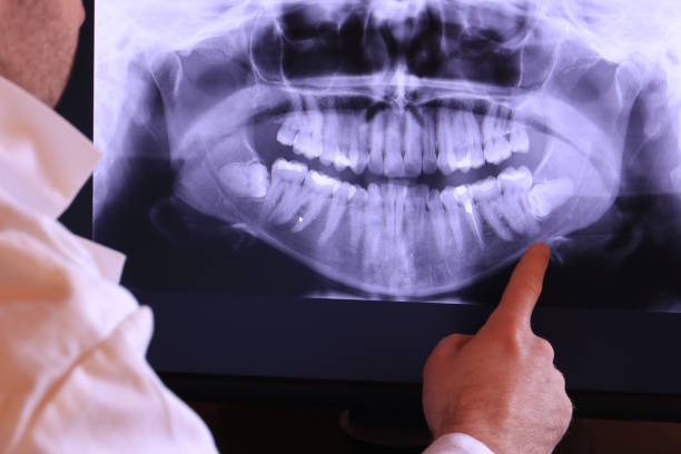Best Weekend Emergency Dentist in Pine Mountain Lake, CA