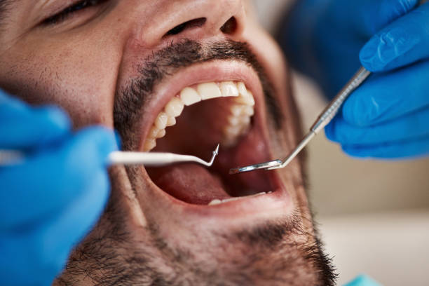 Best Emergency Dental Care for Trauma or Injury in Pine Mountain Lake, CA